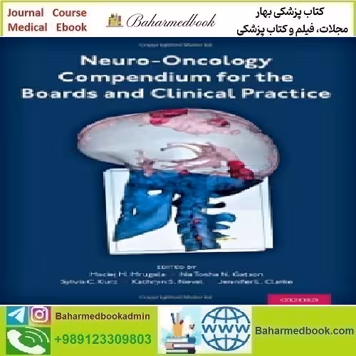Neuro Oncology Compendium for the Boards and Clinical Practi