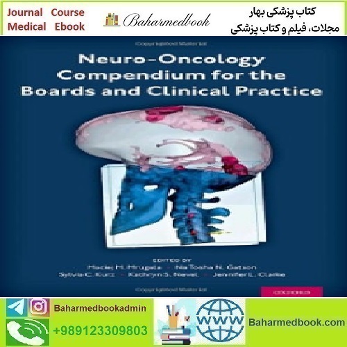 Neuro Oncology Compendium for the Boards and Clinical Practi