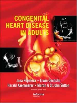 [PDF] دانلود کتاب Congenital Heart Disease In Adults, 2008