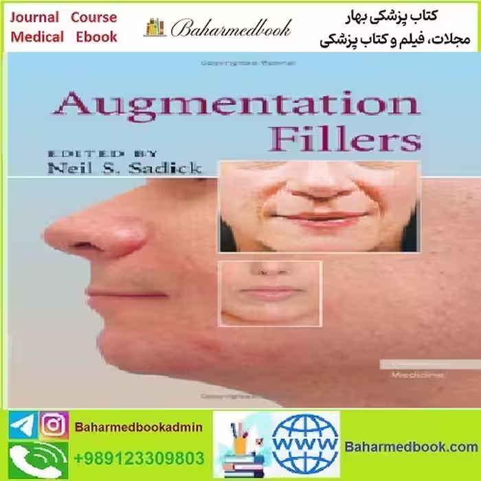 Augmentation Fillers TRUE PDF price 1€ - کتاب پزشکی بهار