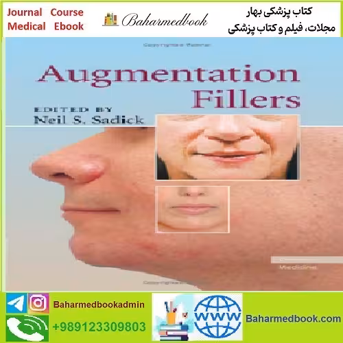 Augmentation Fillers TRUE PDF price 1€ - کتاب پزشکی بهار
