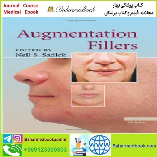 Augmentation Fillers TRUE PDF price 1€ - کتاب پزشکی بهار