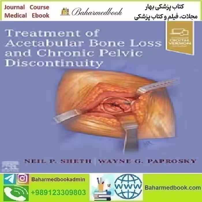 Treatment of Acetabular Bone Loss and Chronic Pelvic Discontinuit