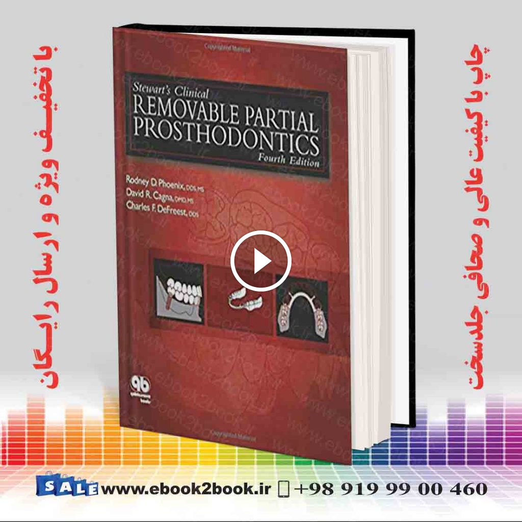 Stewart’s Clinical Removable Partial Prosthodontics 4th Edition