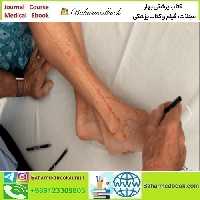 Lyftogt Perineural Injection Treatment How to Treat Periphera