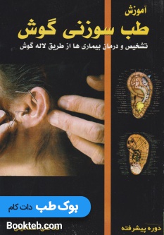 آموزش طب سوزنی گوش تشخیص و درمان بیماری ها از طریق لاله گوش