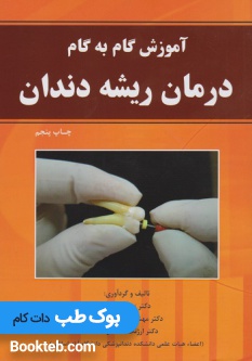آموزش گام به گام درمان ریشه دندان
