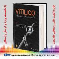 Vitiligo: Medical and Surgical Management