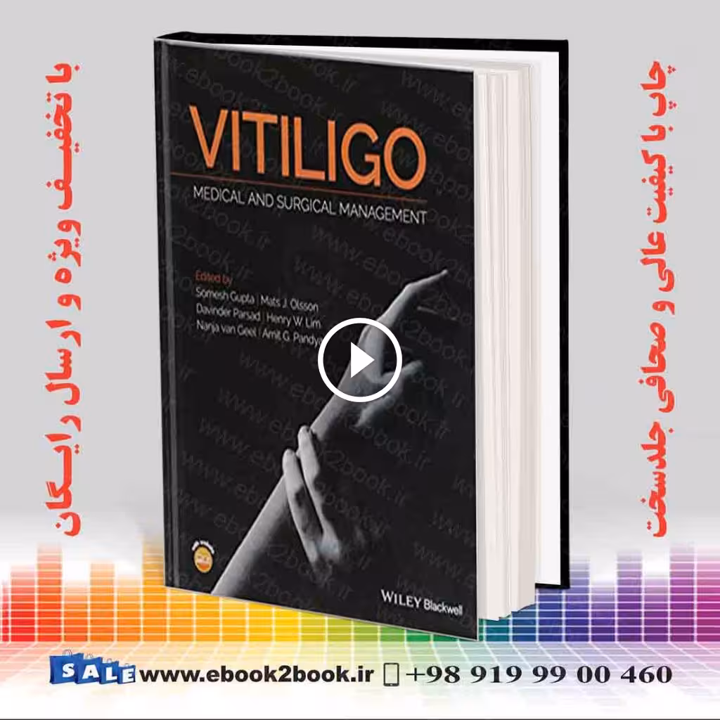 Vitiligo: Medical and Surgical Management