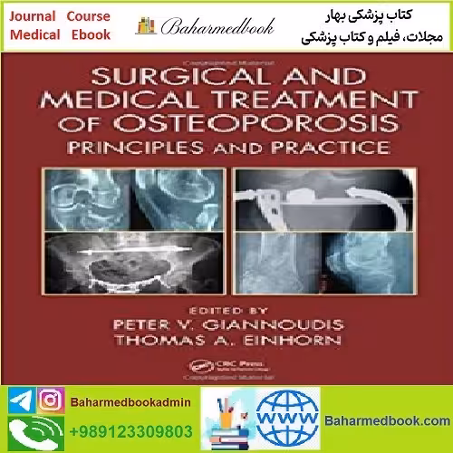 Surgical and Medical Treatment of Osteoporosis TRUE PDF pric