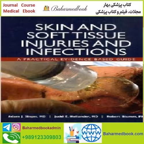 Skin and Soft Tissue Injuries &amp; Infections TRUE PDF price 1€ - کتاب پزشکی بهار
