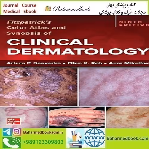 Fitzpatrick's Color Atlas and Synopsis of Clinical Dermatology 202