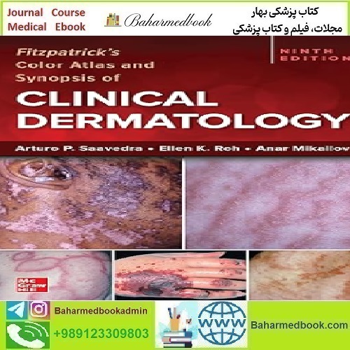 Fitzpatrick's Color Atlas and Synopsis of Clinical Dermatology 202