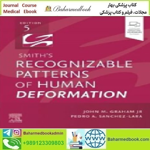 Smith's Recognizable Patterns of Human Deformation 2025 TRU