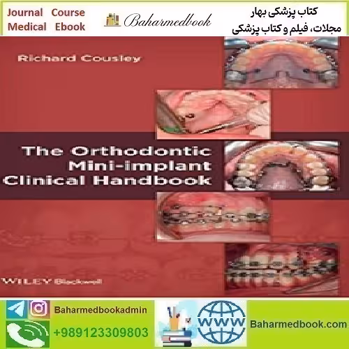 The Orthodontic Mini implant Clinical Handbook 2013