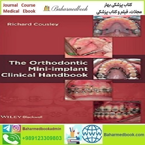 The Orthodontic Mini implant Clinical Handbook 2013
