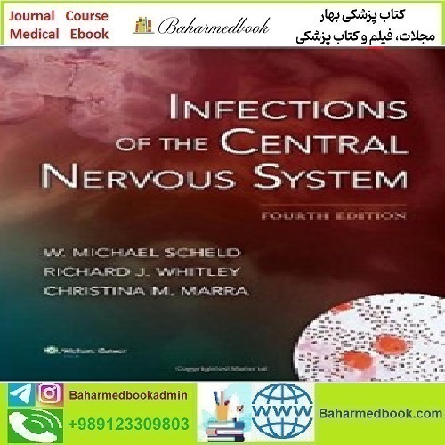 Infections of the Central Nervous System 2014 TRUE PDF price 1€ - کتاب پزشکی بهار