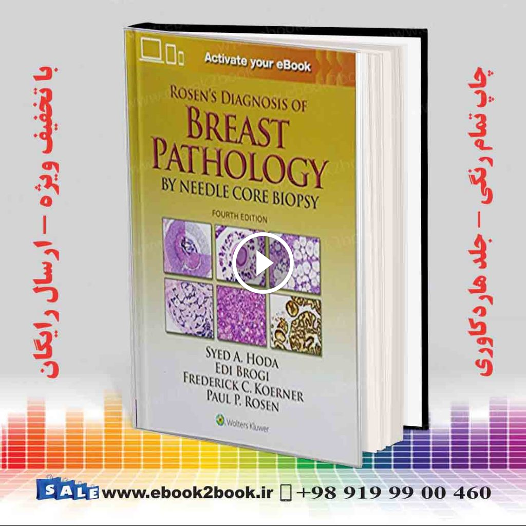 Rosen’s Diagnosis of Breast Pathology by Needle Core Biopsy 4th Edition