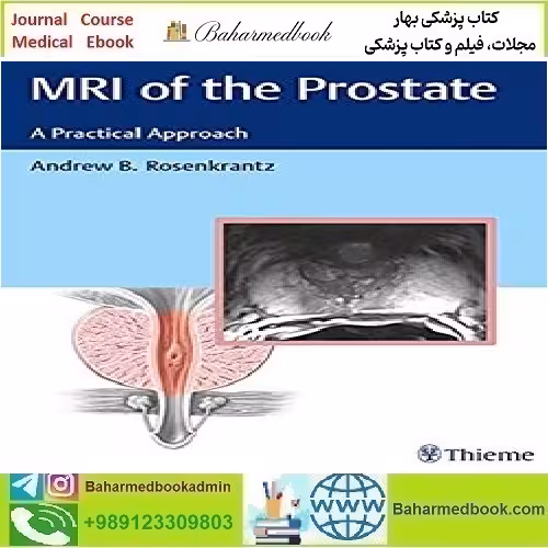 MRI of the Prostate A Practical Approach TRUE PDF price 1€ - کتاب پزشکی بهار
