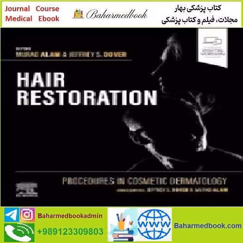Hair Restoration TRUE PDF price 1€