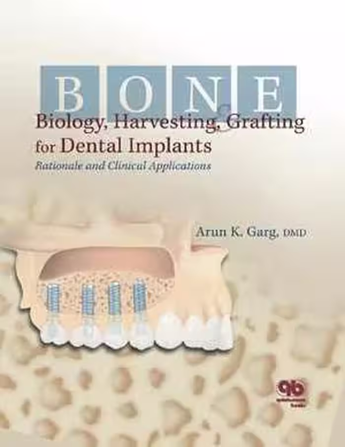 [PDF] دانلود کتاب Bone Biology, Harvesting And Grafting For Dental Implants - Rationale And Clinical Applications, 2004