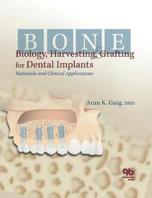 [PDF] دانلود کتاب Bone Biology, Harvesting And Grafting For Dental Implants - Rationale And Clinical Applications, 2004