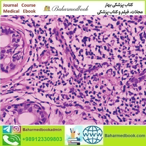Dermatopathology 2023 video course price 35€ - کتاب پزشکی بهار