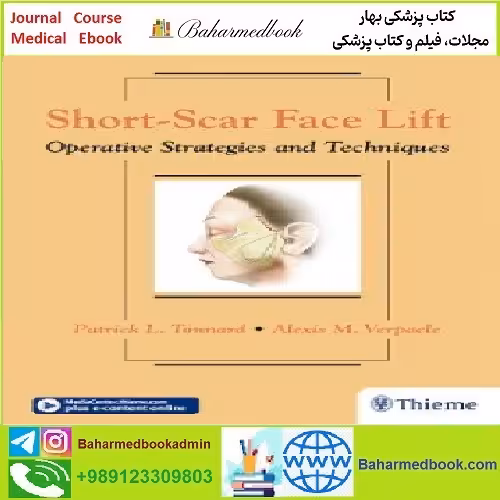 Short Scar Face Lift Operative Strategies and Techniques TRUE