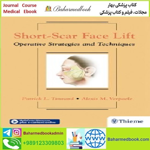 Short Scar Face Lift Operative Strategies and Techniques TRUE