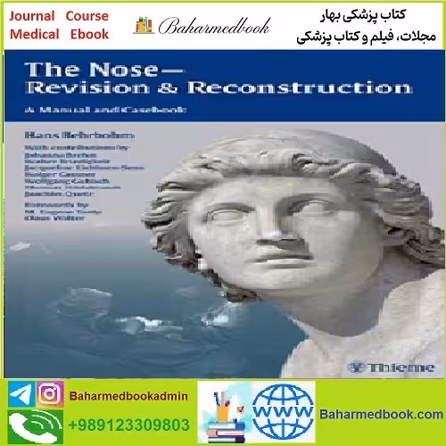 The Nose Revision and Reconstruction TRUE PDF price 1€ - کتاب پزشکی بهار