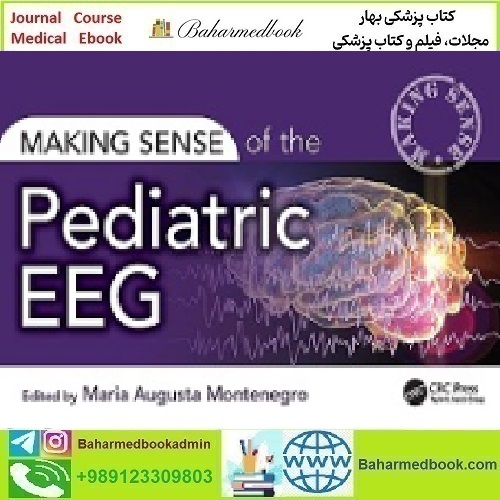 Making Sense of the Pediatric EEG 2024 TRUE PDF price 1€ - کتاب پزشکی بهار