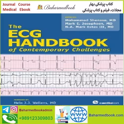 ECG Handbook of Contemporary Challenges TRUE PDF price 1€ - کتاب پزشکی بهار