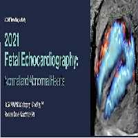 2021 Fetal Echocardiography Normal and Abnormal Hearts at 60€ - کتاب پزشکی بهار