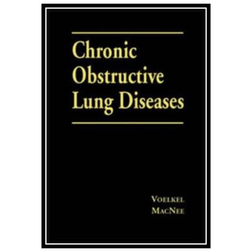 کتاب Chronic Obstructive Lung Disease اثر William Macnee انتشارات مؤلفین طلایی