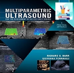 Multiparametric Ultrasound for the Assessment of Diffuse Liver Disease A Practical Approach TRUE PDF price 1€ - کتاب پزشکی بهار