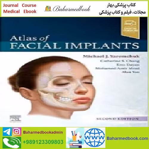 Atlas of Facial Implants TRUE PDF price 1€