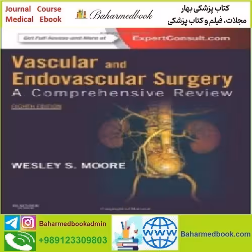 Moore' Vascular and Endovascular Surgery A Comprehensive R