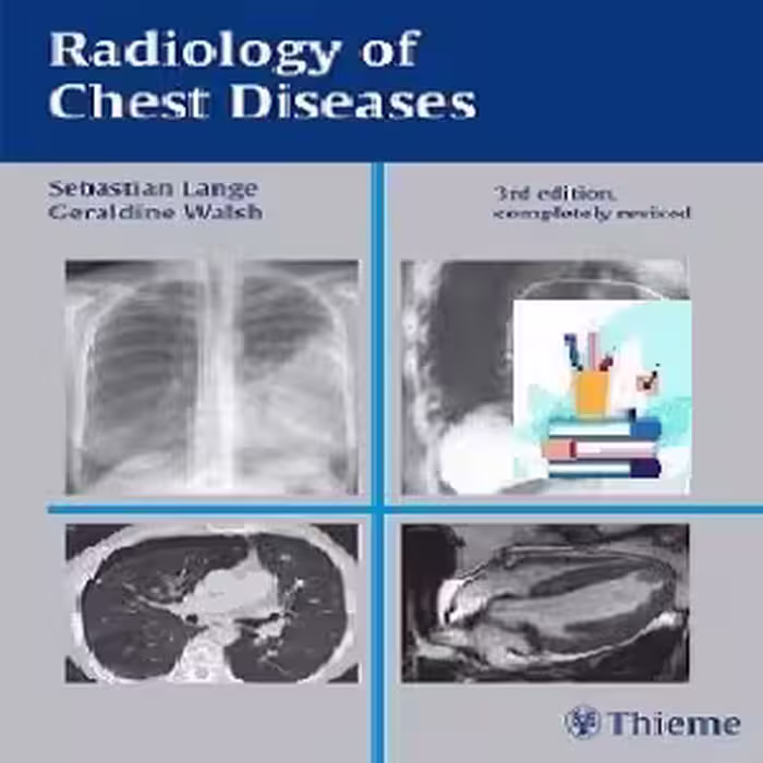 Radiology of Chest Diseases TRUE PDF price 1€