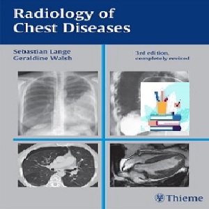 Radiology of Chest Diseases TRUE PDF price 1€