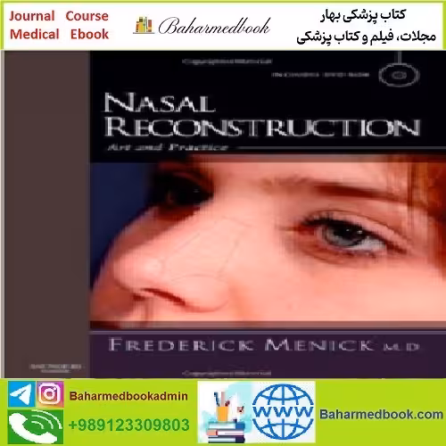Nasal Reconstruction TRUE PDF price 1€ - کتاب پزشکی بهار
