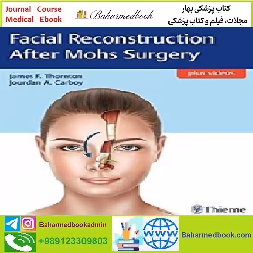 Facial Reconstruction After Mohs Surgery TRUE PDF price 1€ - کتاب پزشکی بهار