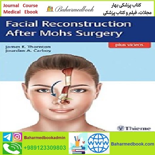 Facial Reconstruction After Mohs Surgery TRUE PDF price 1€ - کتاب پزشکی بهار