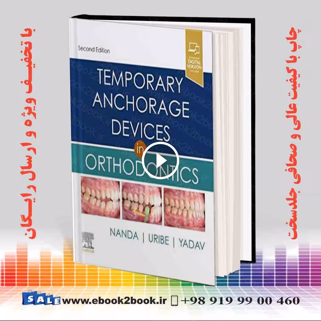 Temporary Anchorage Devices in Orthodontics 2nd Edition