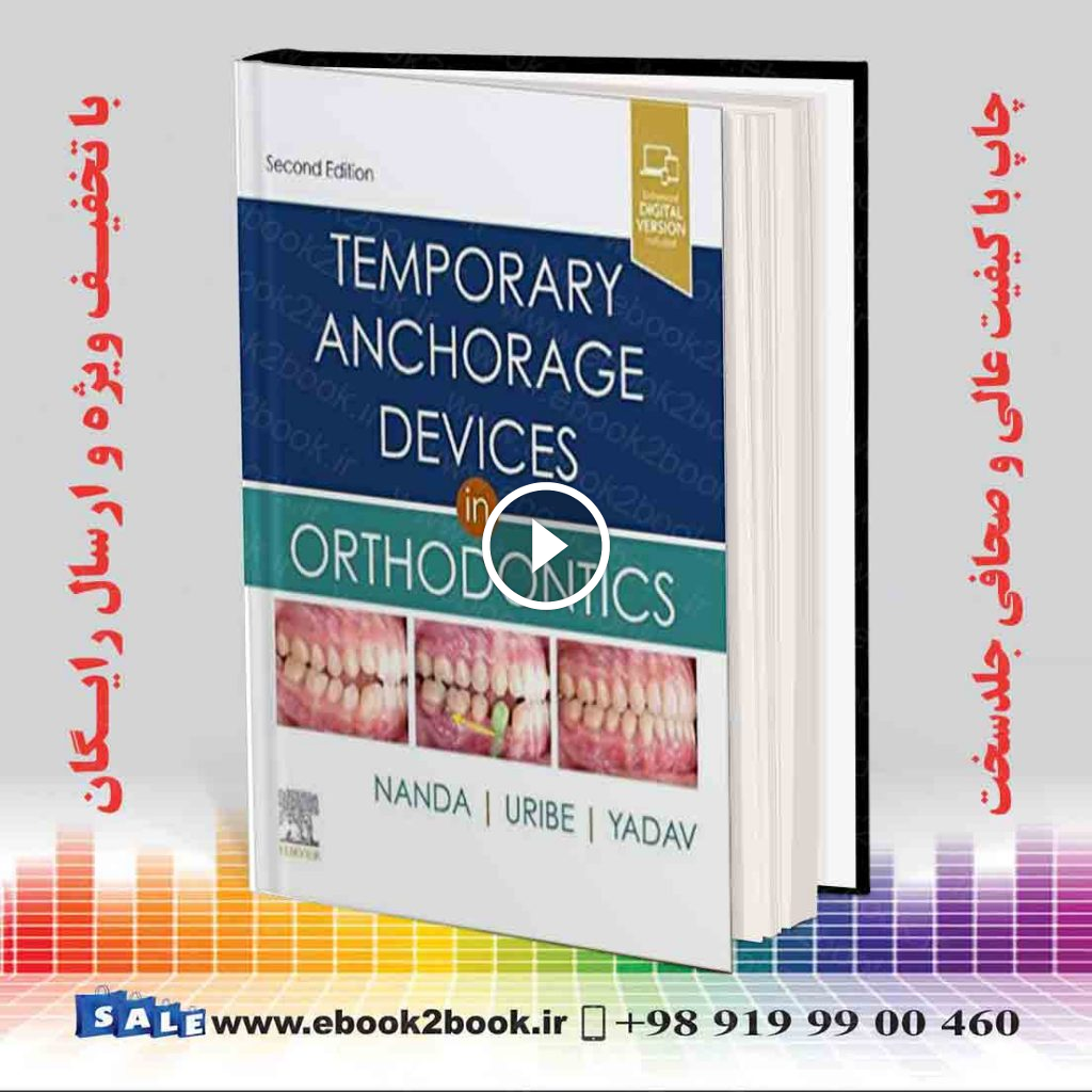 Temporary Anchorage Devices in Orthodontics 2nd Edition