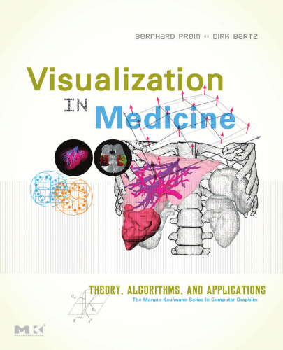 خرید و دانلود نسخه کامل کتاب Visualization in Medicine: Theory, Algorithms, and Applications