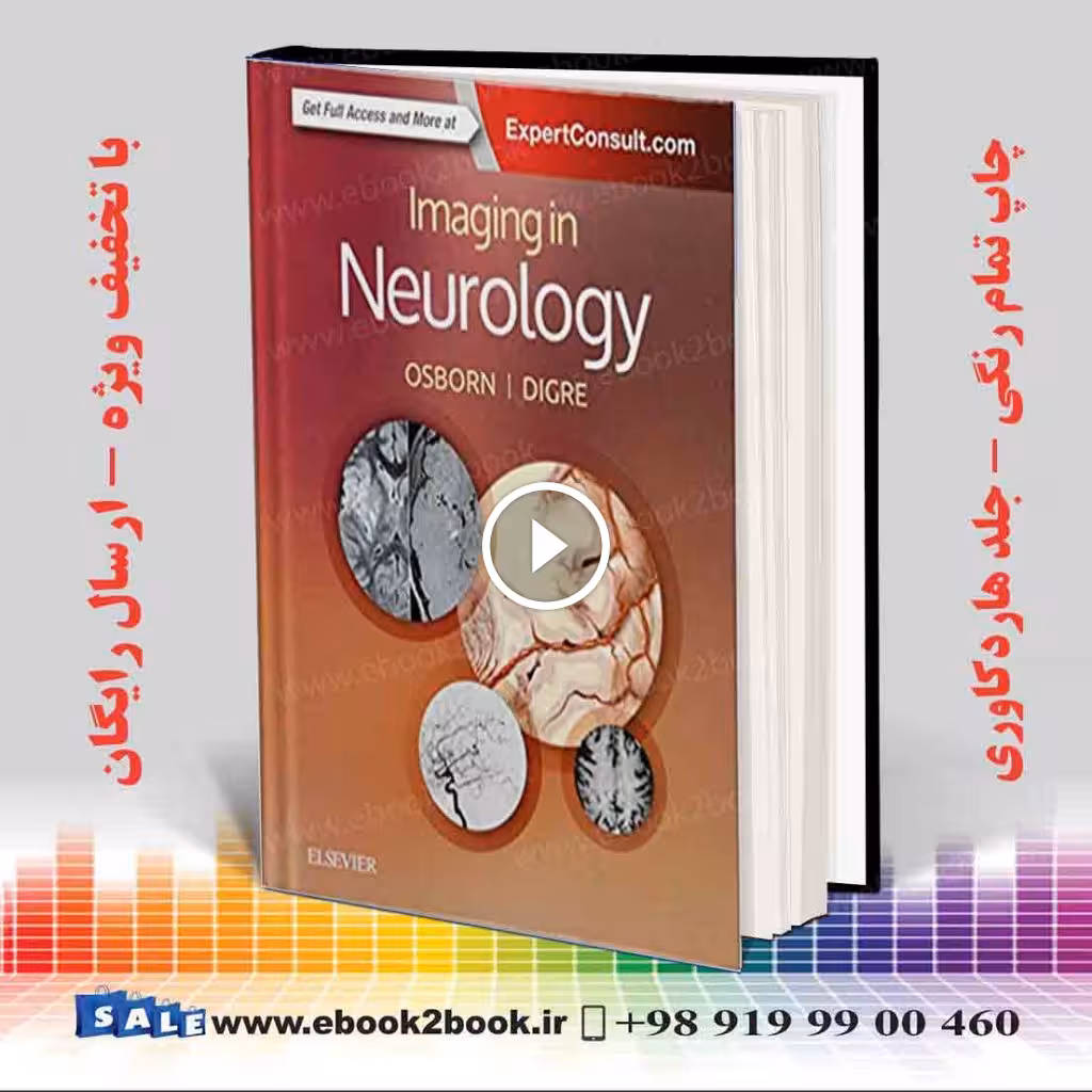 Imaging in Neurology