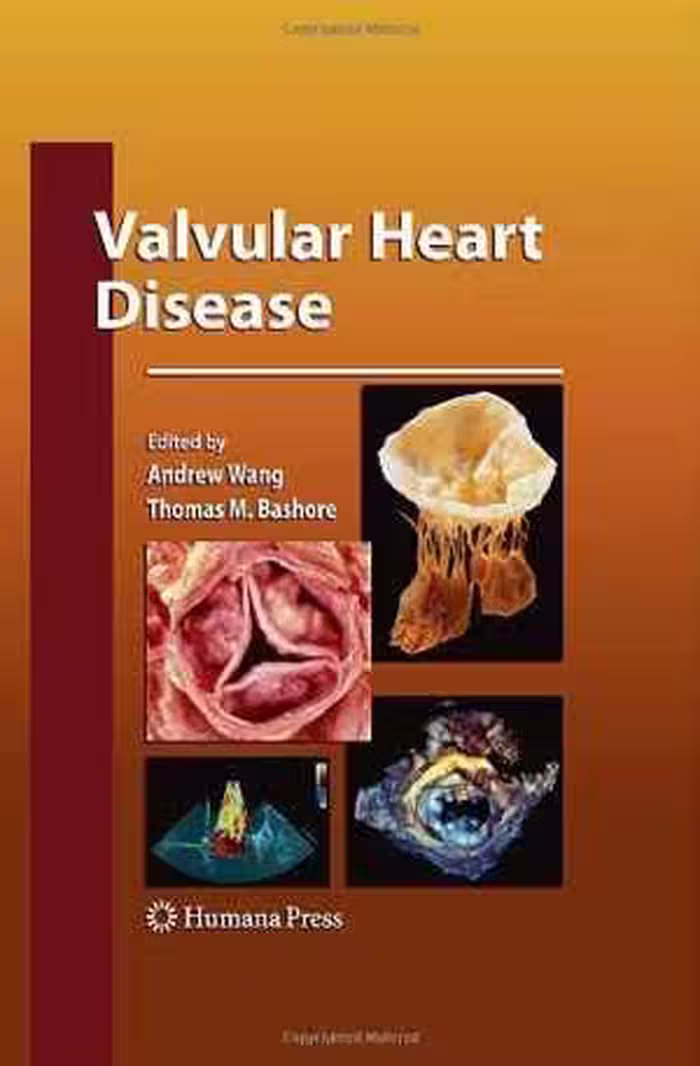 [PDF] دانلود کتاب Valvular Heart Disease, 2009