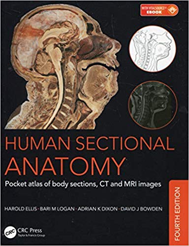  دانلود کتاب Human Sectional Anatomy - Atlas Of Body Sections, Ct And Mri Images, 2015 - دانلود کتاب های دانشگاهی