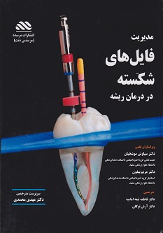 مدیریت فایل های شکسته در درمان ریشه