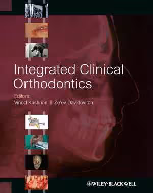 [PDF] دانلود کتاب Integrated Clinical Orthodontics, 2012
